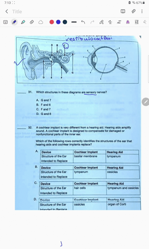 which-structures-in-tnese-diagrams-are-sensory-nerves-gand-fand-6-fand-7-g-and-cochlear-implant-very-different-from-hearing-aid-hearing-alds-amplity-sound-cochlear-implant-is-designed-compen-29248