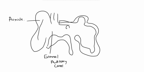 Outer ear the outer ear consists of an external pinna that...