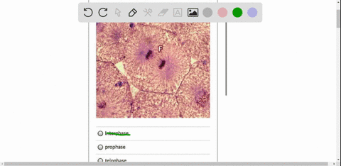 identify-the-stage-that-the-following-cell-is-in-interphase-prophase-telophase-anaphase-metaphase-29927