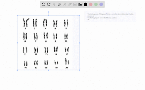 what-is-the-gender-of-this-person-is-this-a-normal-or-abnormal-karyotype-explain-your-answer-use-this-karyotype-to-answer-the-following-questions-xy-91004