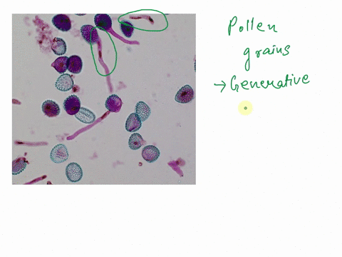 examine-a-slide-showing-mature-pollen-grains-what-two-nuclei-are-present-in-these-grains-make-sure-to-look-around-for-binucleate-cellsl-96114