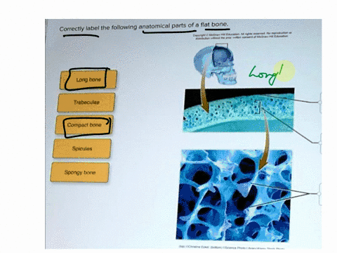 correctly-label-the-following-anatomical-parts-of-a-flat-bone-long-bone-trabeculae-compact-bone-spicules-spongy-bone-p0ch-26614