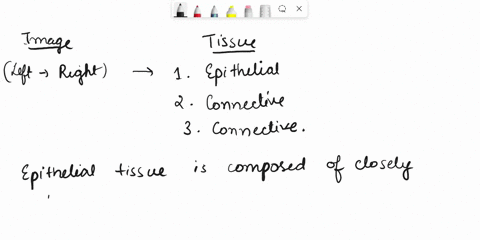 identify-the-class-of-tissue-to-which-each-example-belongs-epithelial-tissue-connective-tissue-muscle-tissue-nervous-tissue-muscle-tissue-muscle-tissue-nervous-tissue-33584