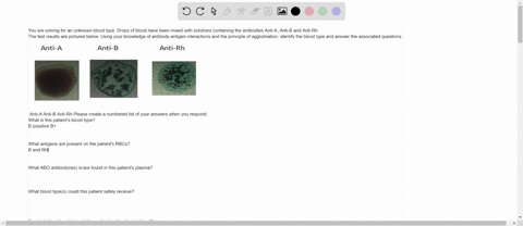 you-are-solving-for-an-unknown-blood-type-drops-of-blood-have-been-mixed-with-solutions-containing-the-antibodies-anti-a-anti-b-and-anti-rh-the-test-results-are-pictured-below-using-your-kno-22548
