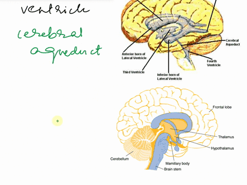 1-locate-the-right-lateral-ventricle-and-rotate-the-view-to-examine-the-third-ventricle-found-between-the-two-cerebral-hemispheres-only-one-is-visibleuse-the-book-icon-to-read-a-description-67498