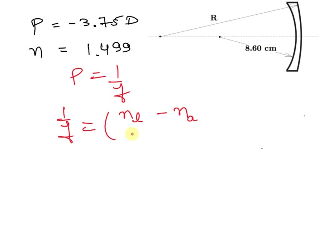 SOLVED The figure illustrates qualitatively a corrective lens of 3.75