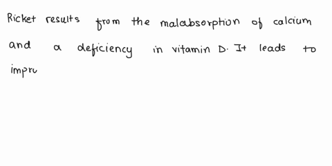 rickets-results-in-improper-bone-development-in-children-that-arises-from-the-malabsorption-of-calci-35384