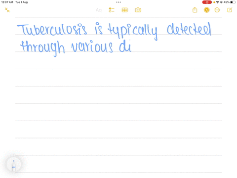 how-is-tuberculosis-detected
