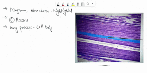 which-structures-are-highlighted-dendrites-nissl-bodies-axons-cell-bodies-91549