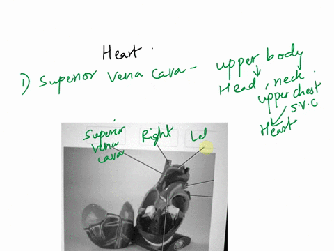 14-lebcetho-structures-indicated-on-this-anterior-view-of-the-heart-and_-vessels-model-associated-blood-len-pumonary-6042-e-rot-etch-ochent-spaoiena-plimonsy-bunt-lch-puttonar-eneny-81591