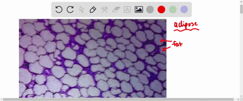 this-tissue-is-found-in-tendons-provides-supporting-framework-serves-as-an-energy-reserve-is-part-of-the-integument-resists-pulling-forces-11544