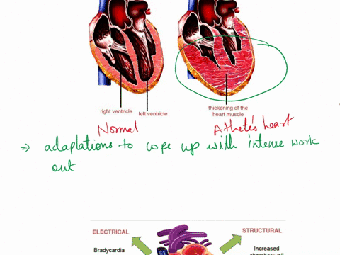 describe-the-structural-characteristics-identified-by-baggish-and-wood-2011-that-are-associated-with-the-athletes-heart-how-does-the-athletes-heart-differ-from-heart-pathologies-according-to-22546