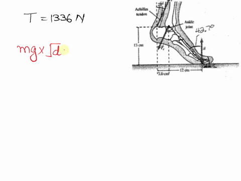 7-the-figure-shows-the-foot-and-lower-leg-of-a-person-standing-on-the-ball-of-one-foot-three-forces-act-to-maintain-the-equilibrium-the-tension-force-t-1336-n-in-the-achilles-tendon-the-cont-13028