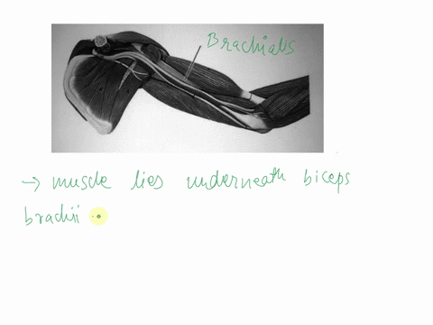 Which muscle is highlighted? LT-M11:Deluxe Muscular Arm, 6-part, 3B ...