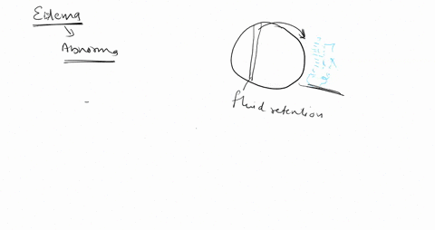 33-pls-quastion-20-in-the-field-of-medicine-concepts-like-tonicity-and-osmosis-are-important-t0-consider-when-administering-intravenous-iv-salinelfluids-t0-patients-doclors-have-ihe-choice-o-92378