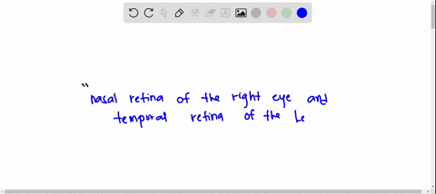 the-left-optic-nerve-contains-axons-of-ganglion-cells-in-temporal-retina-of-the-right-eye-and-nasal-retina-of-the-left-eye-nasal-retina-of-the-right-eye-and-temporal-retina-of-the-left-eye-t-04019