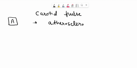 question-405-points-using-a-search-of-the-internetdetermine-which-of-the-following-statements-regarding-the-carotid-pulse-is-true-the-carotid-pulse-is-an-unreliable-way-to-determine-heart-ra-57565