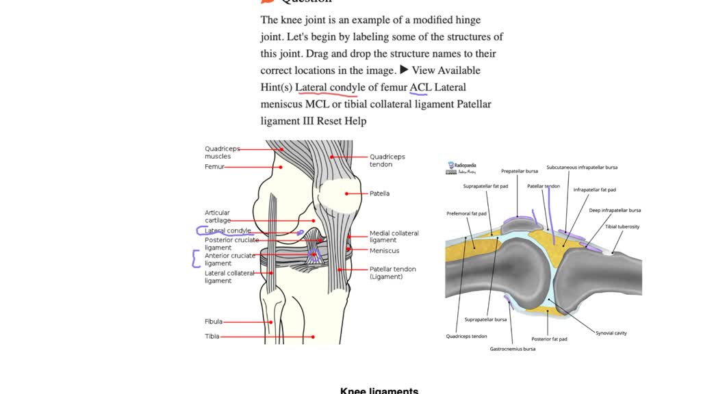The knee joint is an example of a modified hinge joint. Let's begin by