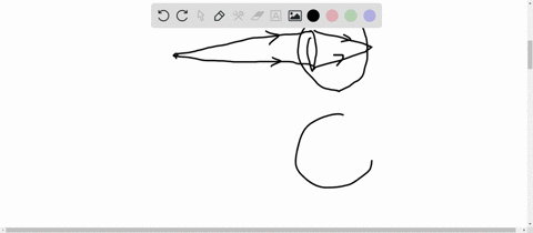 what-is-one-surgical-way-to-correct-nearsighted-vision-a-reduce-the-curvature-of-the-cornea-thus-red-41096