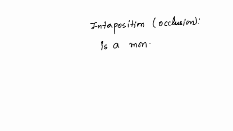interposition-occlusion-is-a-binocular-cue-that-relies-on-light-and-shadow-is-a-monocular-cue-that-uses-partially-blocked-objects-to-infer-depth-is-a-binocular-cue-based-on-closeness-is-a-monocular-cu