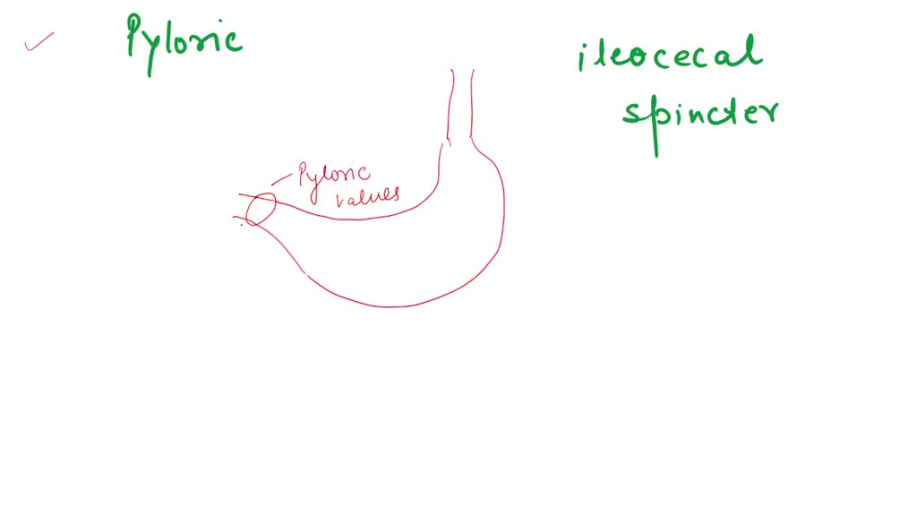 SOLVED This is located between the pyloric and ileocecal sphincters