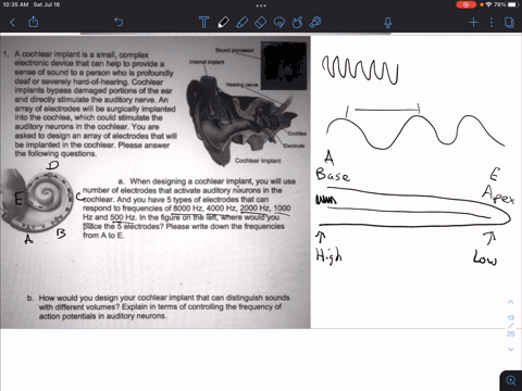 bound-prooeesor-a-cochlear-implant-is-small-complex-electronic-device-that-can-help-to-provide-sense-of-sound-t0-person-who-i8-profoundly-deaf-or-severely-hard-ol-hearing-cochlear-implants-b-01516