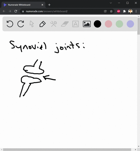 which-type-of-joint-provides-the-greatest-range-of-motion-a-ball-and-socket-b-hinge-c-condyloid-d-pl-52132