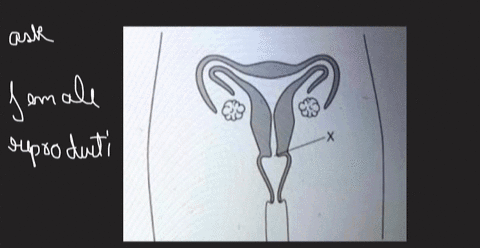 the-diagram-shows-a-human-female-s-reproductive-organs-structure-x-the-name-what-is-cervix-oviduct-ovaly-ovule-16741