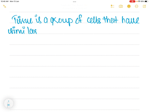 which-of-the-following-best-describes-a-tissue-group-of-answer-choices-a-group-of-organs-that-all-have-similar-functions-a-group-of-similar-cells-that-serve-the-same-purpose-a-random-collect-20535