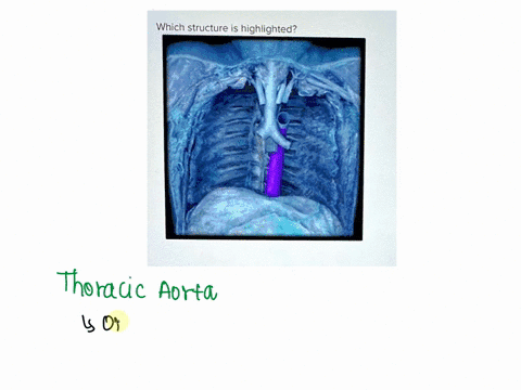 which-structure-is-highlighted-pulmonary-artery-thoracic-aorta-ascending-aorta-aortic-arch-abdominal-aorta-ovascular-and-respiratory-syi-s-which-structure-is-highlighted-multiple-choice-pulm-65623