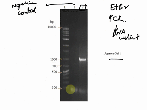 the-ethidium-bromide-stained-agarose-gel-below-shows-the-results-of-a-pcr-analysis-for-a-dna-insert-contained-within-a-recombinant-bacterial-plasmid-clone-lane-2-lane-is-the-pcr-negative-con-94948