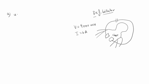 a-a-defibrillator-a-device-that-stores-charge-on-a-capacitor-used-to-start-the-heart-beat-of-a-patient-under-cardiac-arrest-after-suffering-irregular-heartbeats-sends-a-6-a-current-through-t-91945