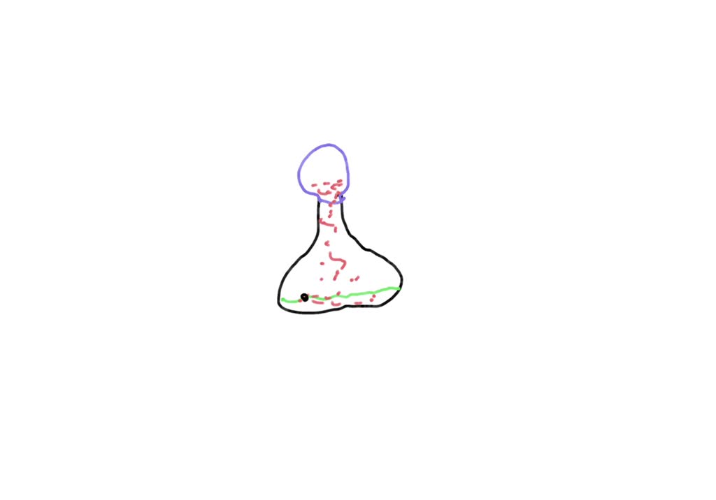 SOLVED Kenzie placed .5 grams of baking soda in a balloon and 25 mL of