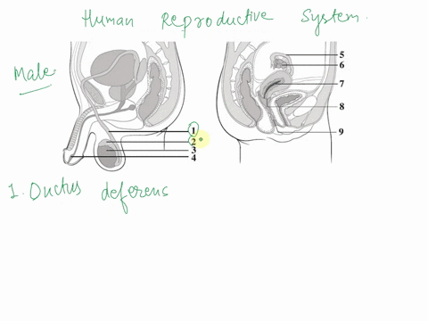 in-men_-untreated-sexually-transmitted-infections-stis-caused-by-bacteria-may-cause-inflammation-of-the-epididymides_-condition-known-as-epididymitis-in-women_-untreated-stis-may-cause-infla-43638