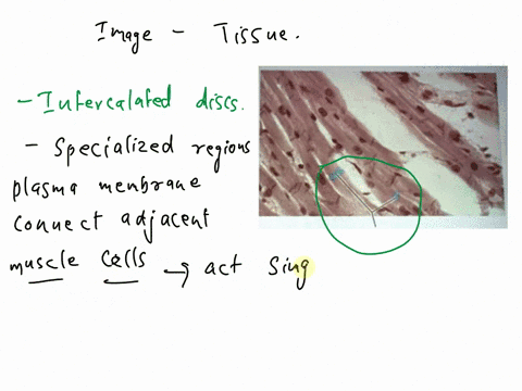 question2s-which-structure-is-highlighted-striations-o-sarcomeres-nuclei-ointercalated-aiscs-00335