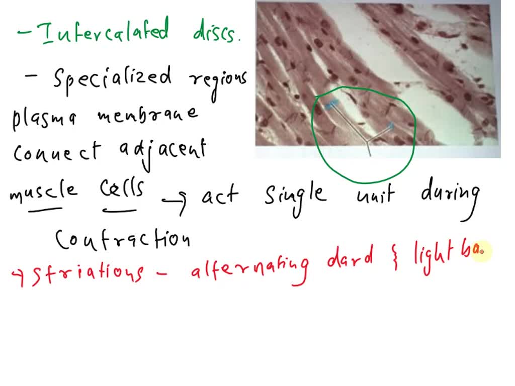 SOLVED Which structure is highlighted? Striations, nuclei