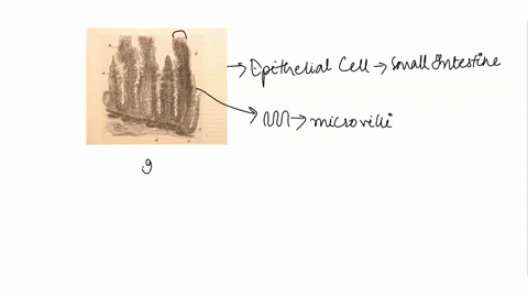 tne-picture-below-is-of-epithelial-cells-from-the-smiall-intestine-discuss-how-aspects-of-their-structure-contribute-to-their-speclalized-functions-of-nutrient-absorption-and-as-barrier-betw-41593