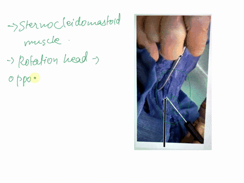 clickheretoenteransw-dissection-of-the-anterior-neck-identify-the-muscle-and-its-action-in-the-picture-above-specified-by-the-arrow-and-the-lab-instructors-black-pointer-34239