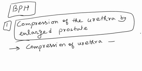 which-of-the-following-may-occur-as-a-result-of-benign-prostatic-hyperplasia-multiple-answers-may-be-possible-predisposition-to-prostate-cancer-testicular-atrophy-compression-of-the-urethra-52621