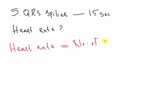 there-are-5-qrs-spikes-in-15-seconds-calculate-the-heart-rate-a-03-beats-per-min-b-5-beats-per-min-c-3-beats-per-min-d-20-beats-per-min-88928