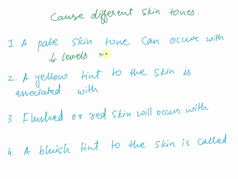 complete-the-sentences-about-the-causes-of-different-skin-tones-complete-the-sentences-about-the-causes-of-different-skin-tones-1a-pale-skin-tone-can-occur-withclick-to-select-2a-yellow-tint-49607