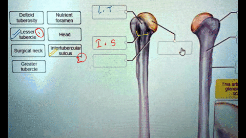 correctly-label-the-anatomical-features-of-the-humerus-deitoid-tuberosity-nutrient-foramen-lesser-lubercle-head-intertuberculal-sulcus-surgical-neck-grealer-tubercle-thts-artkculales-glenold-64595