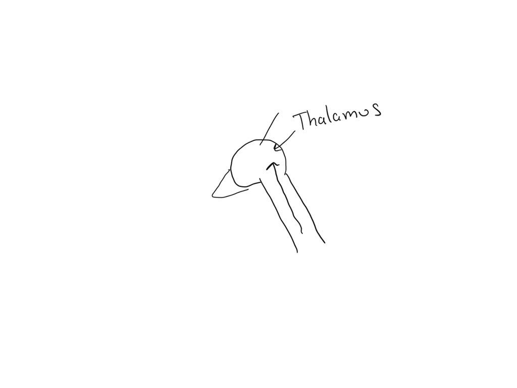 SOLVED Which structure associated with the brain stem acts as a relay