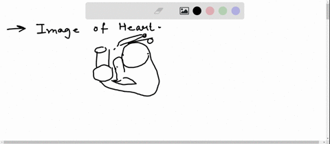a-e-o-search-t-identify-e-a-pulmonary-semilunar-valve-b-pulmonary-trunk-c-aortic-semilunar-valve-dapex-e-aorta-51892