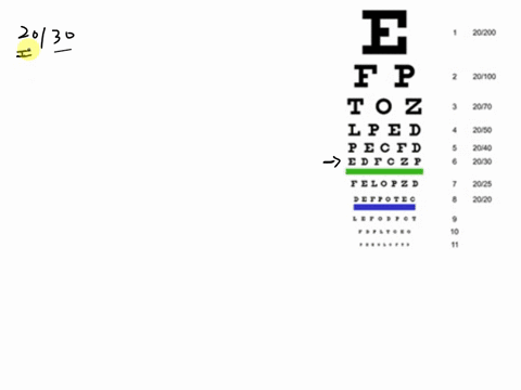 question-4-shown-below-is-a-version-of-snellen-chart-used-to-measure-visual-acuity-suppose-that-a-person-can-read-line-6-with-left-eye-what-does-this-mean-with-respect-to-seeing-objects-with-16935