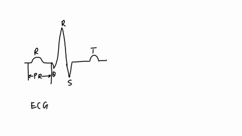 which-is-the-longest-lasting-phase-for-a-healthy-heart-pr-interval-st-segment-qrs-complex-pr-segment-qt-interval