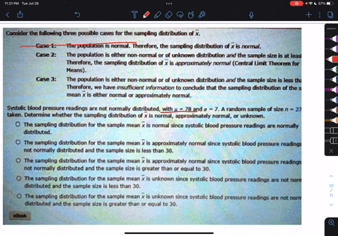 consider-the-following-three-passible-cases-for-the-sampling-distribution-dx-cas-1-case-2-the-population-is-normal-therefore-the-sampling-distribution-d-x-is-normal-the-population-is-either-08715