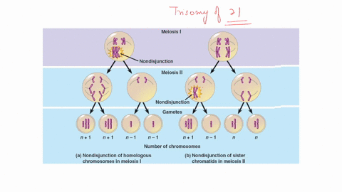 nondisjunction-in-cell-division-is-rare-but-a-number-of-chromosomal-abnormalities-have-been-documented-choose-one-in-which-a-full-or-partial-chromosome-is-missing-or-added-to-a-cell-causing-29636
