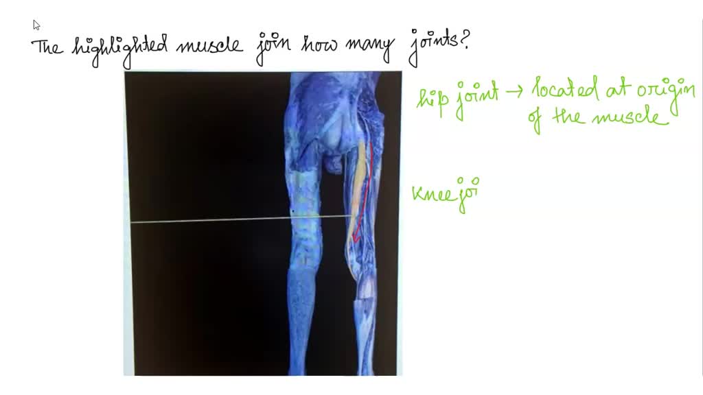 SOLVED: The highlighted muscle crosses how many joints?