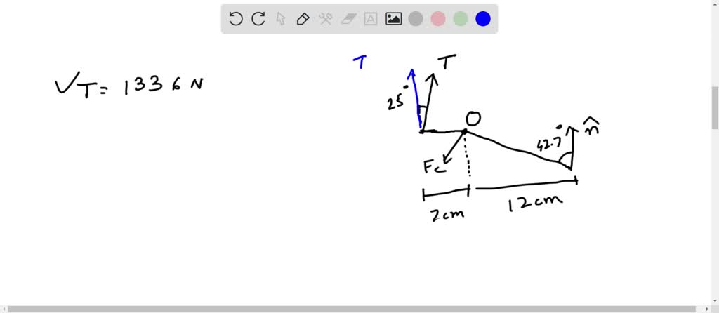 SOLVED: The figure shows the foot and lower leg of a person standing on ...